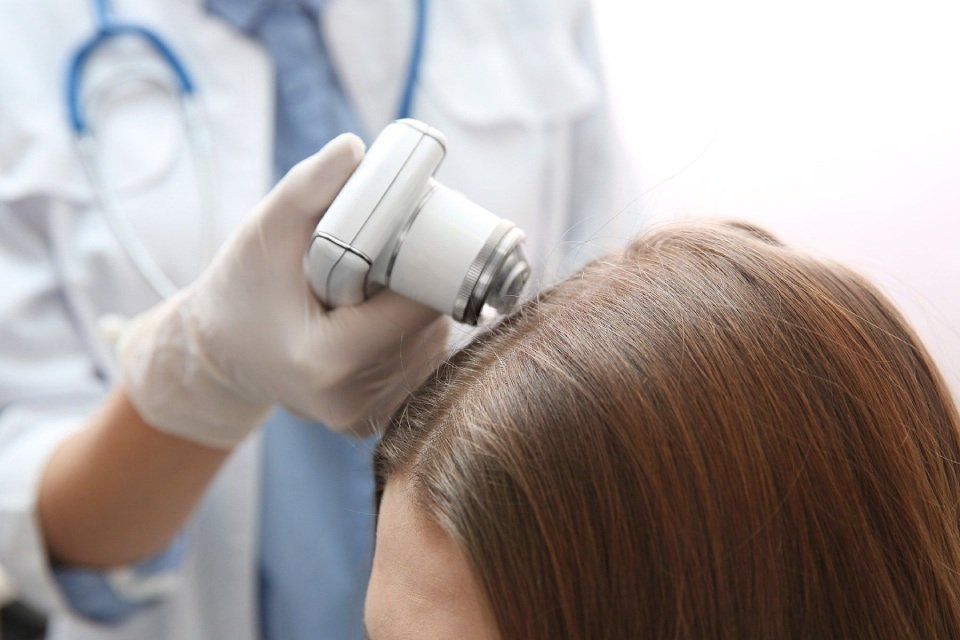 analisi dei capelli e del cuoio capelluto