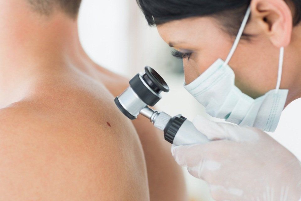 epiluminescenza per la mappatura dei nei