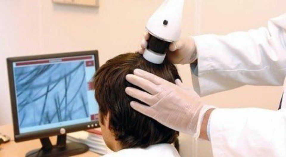 analisi computerizzata del capello