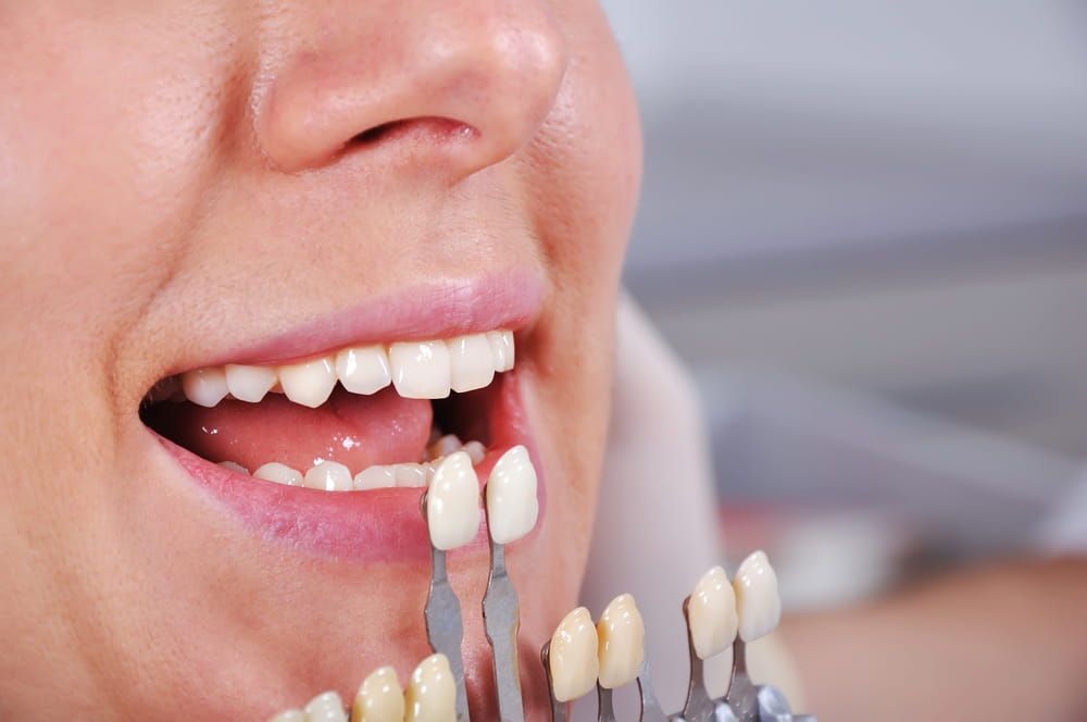 A Close Up of a Woman's Teeth Being Examined by a Dentist — New Horizons Dental in Port Douglas, QLD