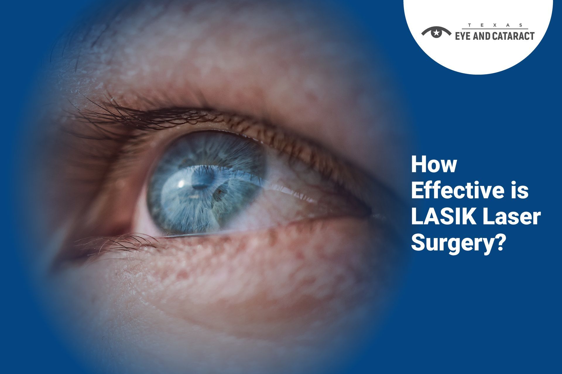 Understanding The Difference Between Traditional And Laser Cataract Surgery