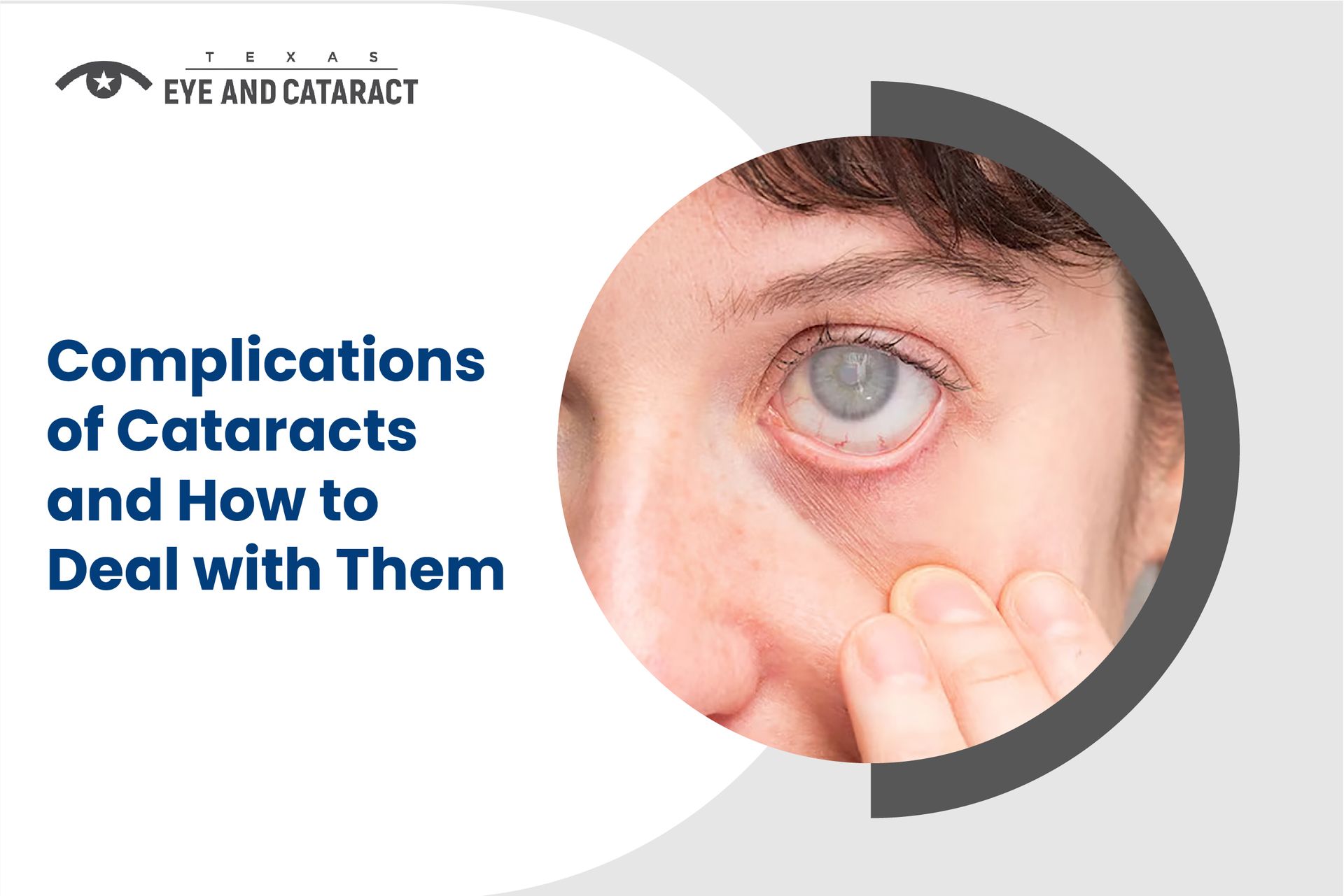 cataract surgery complications