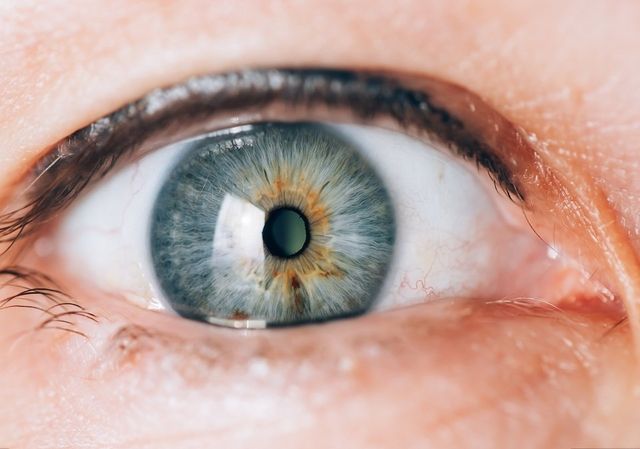 4 Things You Should Know About Eye Lens Replacement Surgery