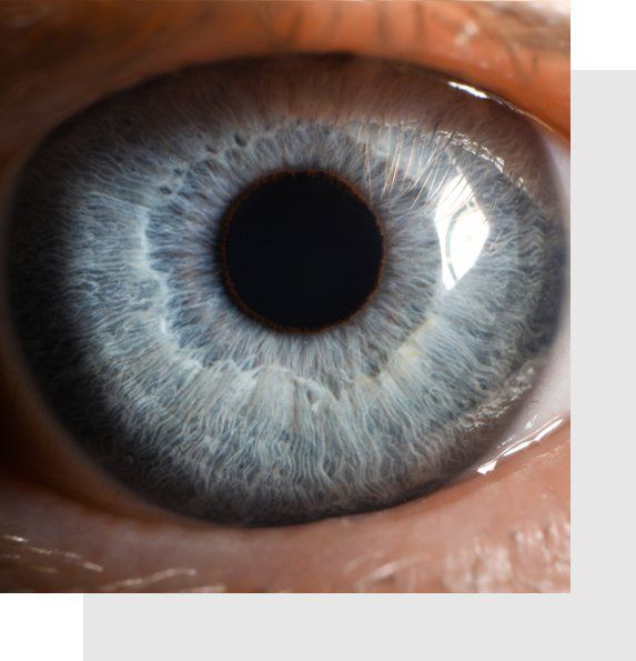 LASIK Eye Surgery - Ophthalmologist Waxahachie