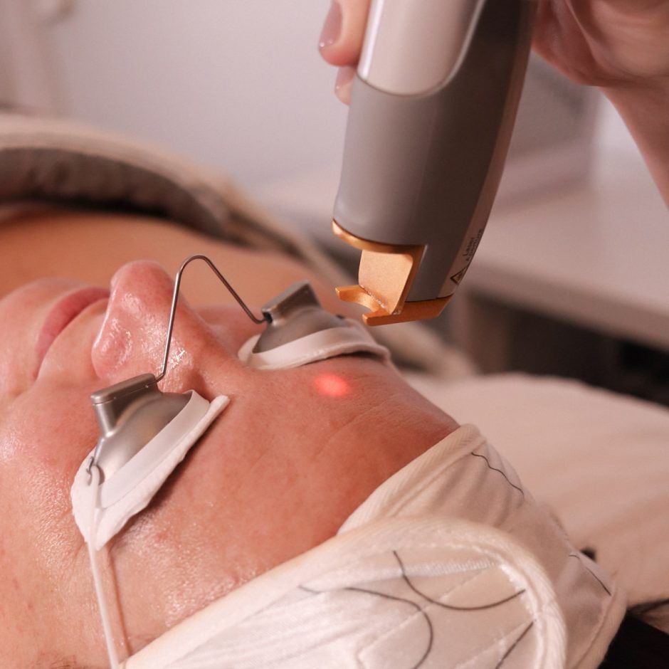 Facial laser treatment on a patient's nose and cheek with protective eye covers