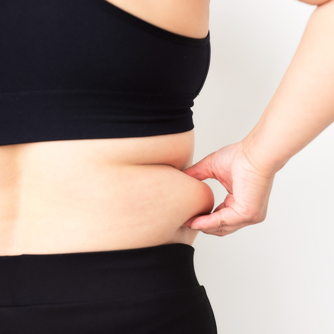 Woman with dark hair looking at the camera, light skin, and several dark spots.