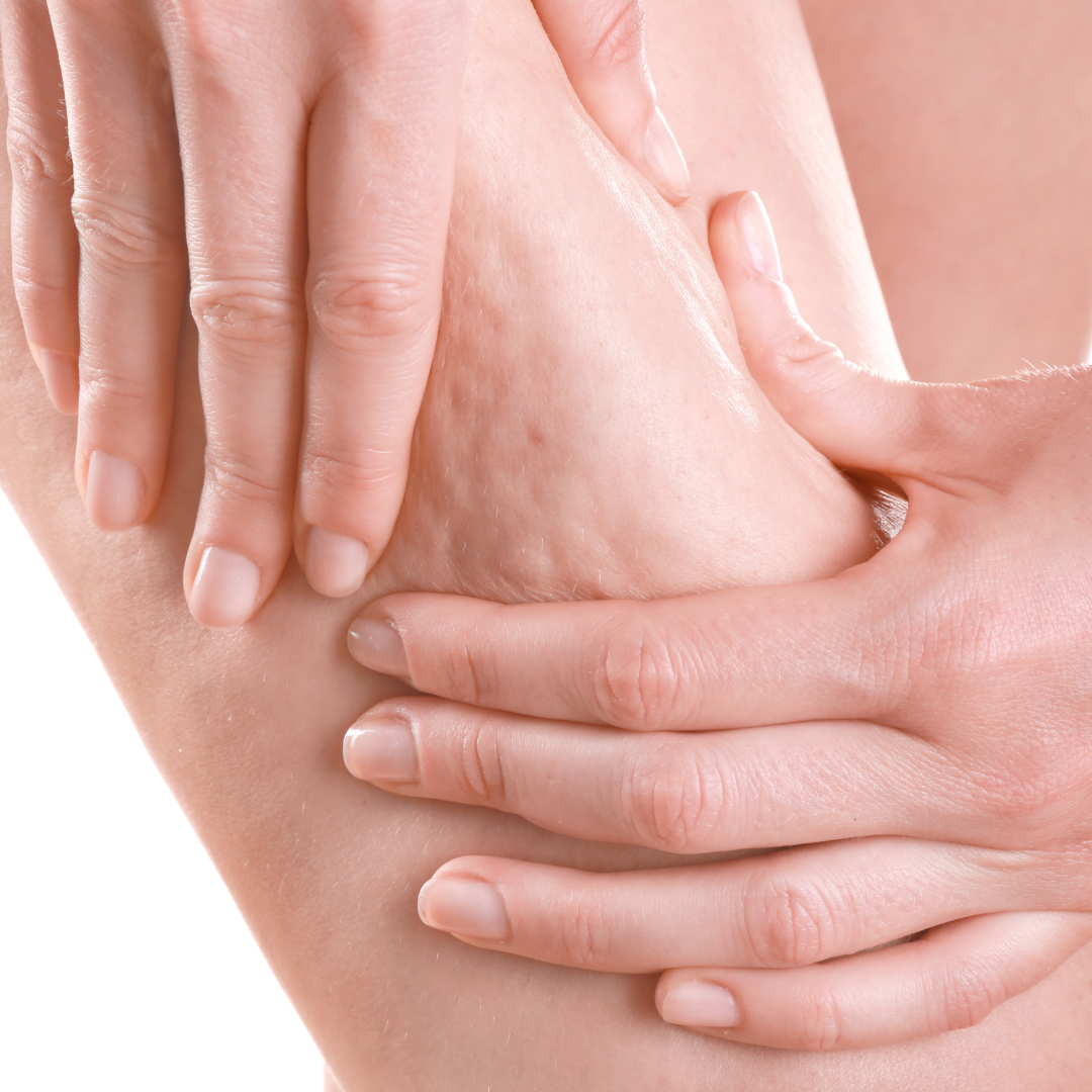 Hand squeezing skin on thigh, highlighting cellulite on a light background.