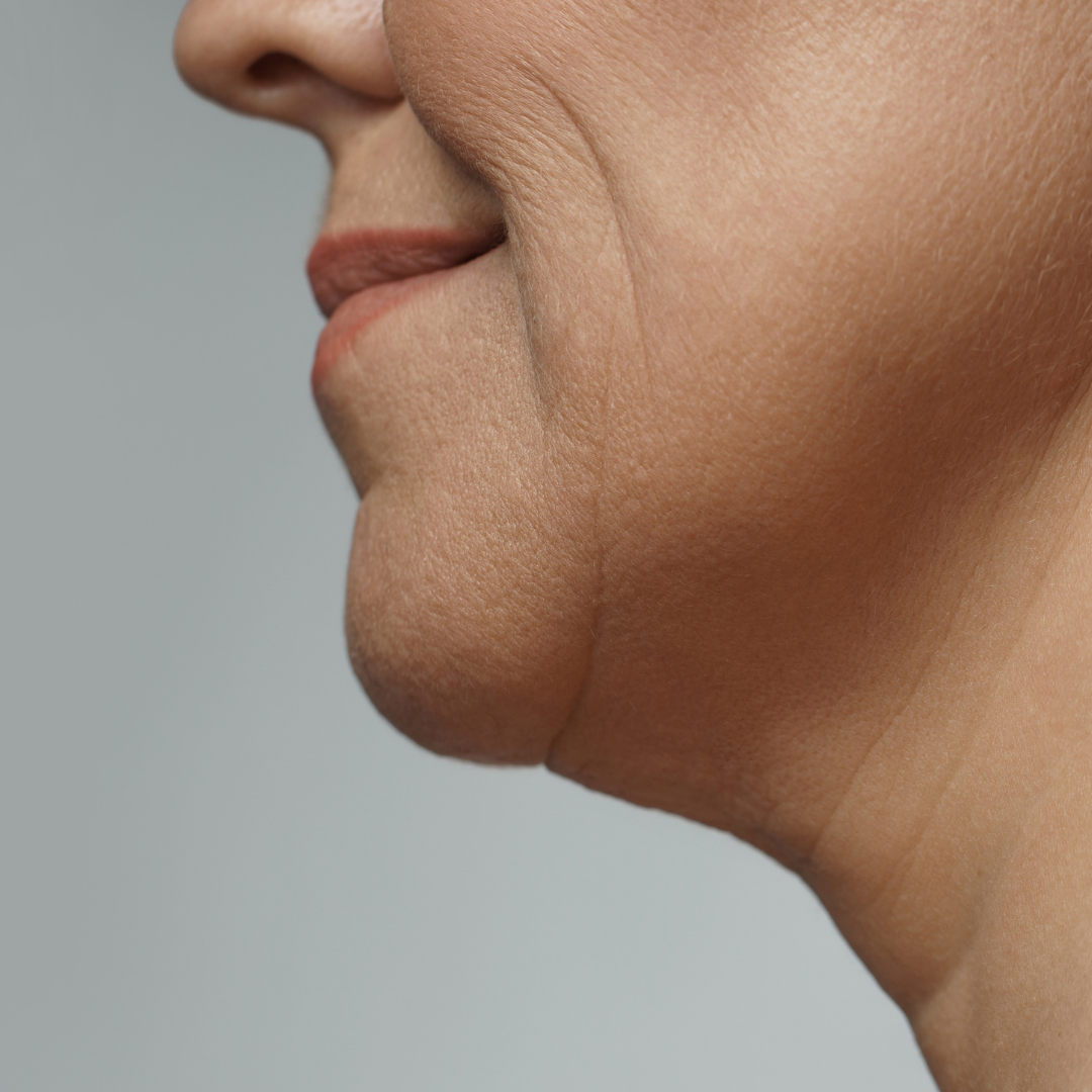 Close-up of a person's lower face and neck, showing a double chin and slightly parted lips.