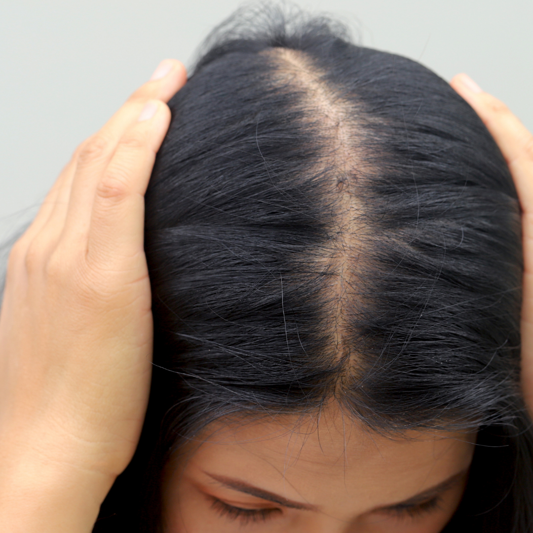 Person in black underwear pinching excess skin on abdomen.