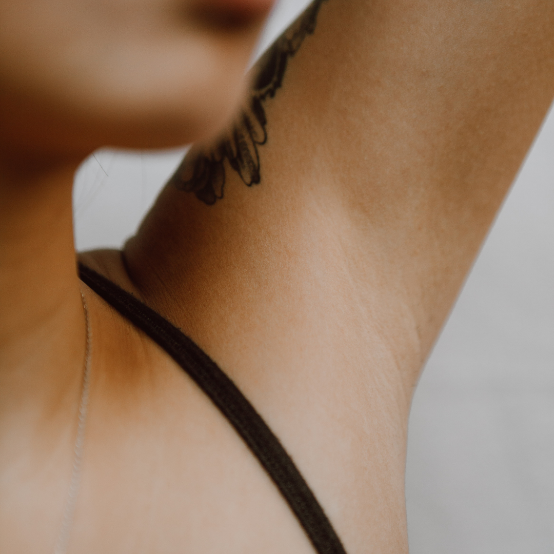 Close-up of a person's face with visible dark patches on the cheek, likely hyperpigmentation.