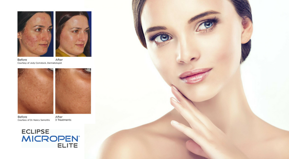 A woman with a before and after picture of her face
