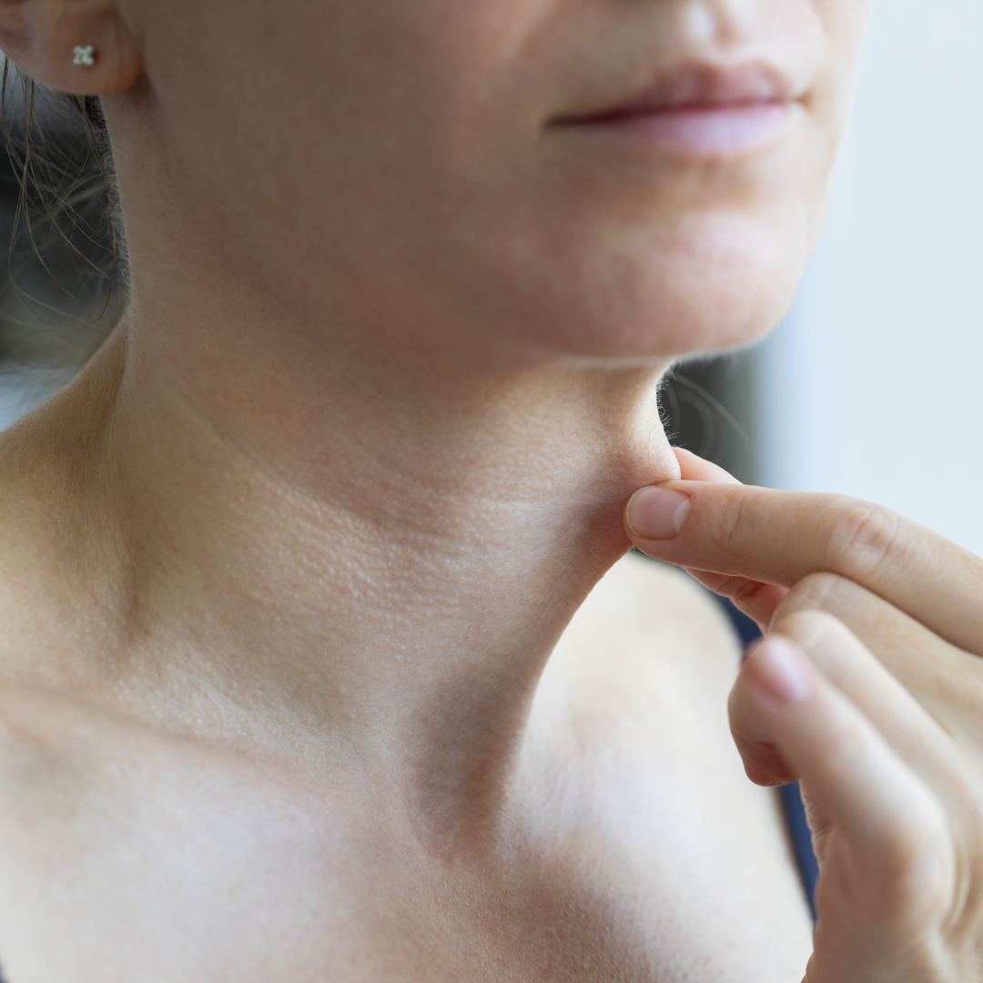 Person's abdomen in black underwear, hands pinching excess skin on sides of belly.