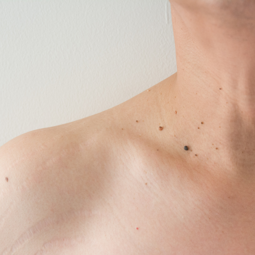 Woman in white tank top touching her armpit.