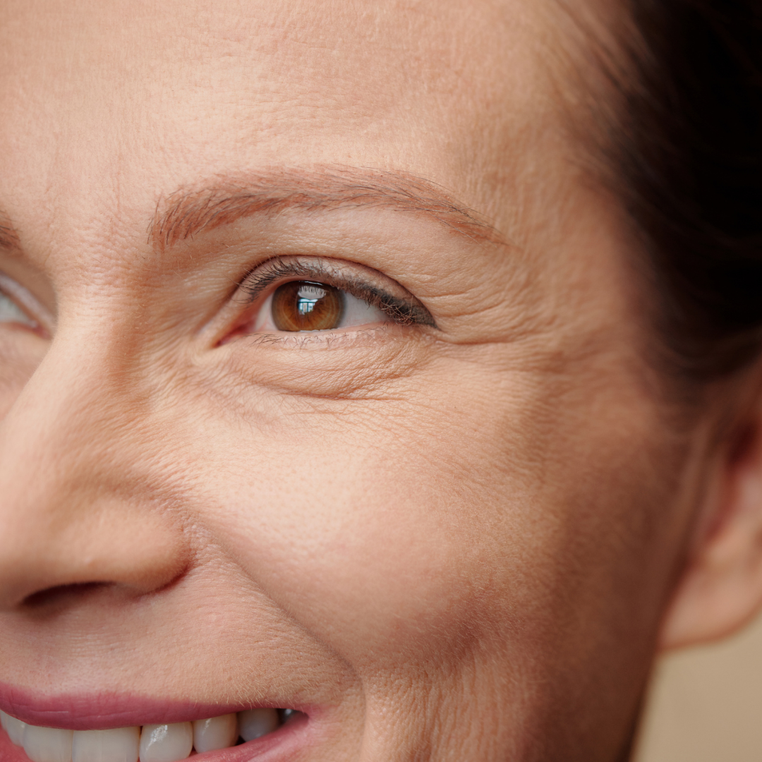 Woman looking in a mirror, touching her cheek. Her face has dark spots. Gray background.