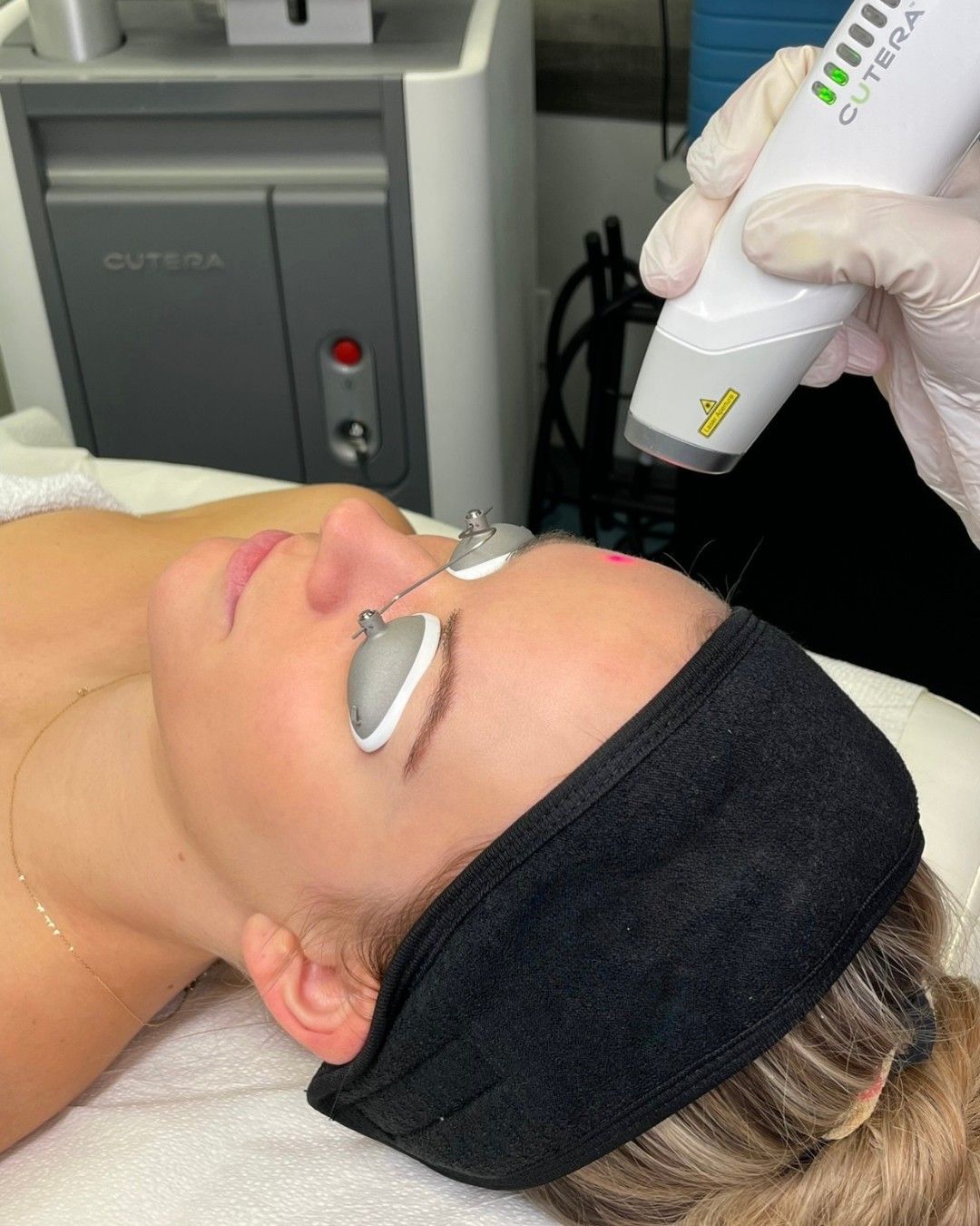 A woman is getting a laser treatment on her face
