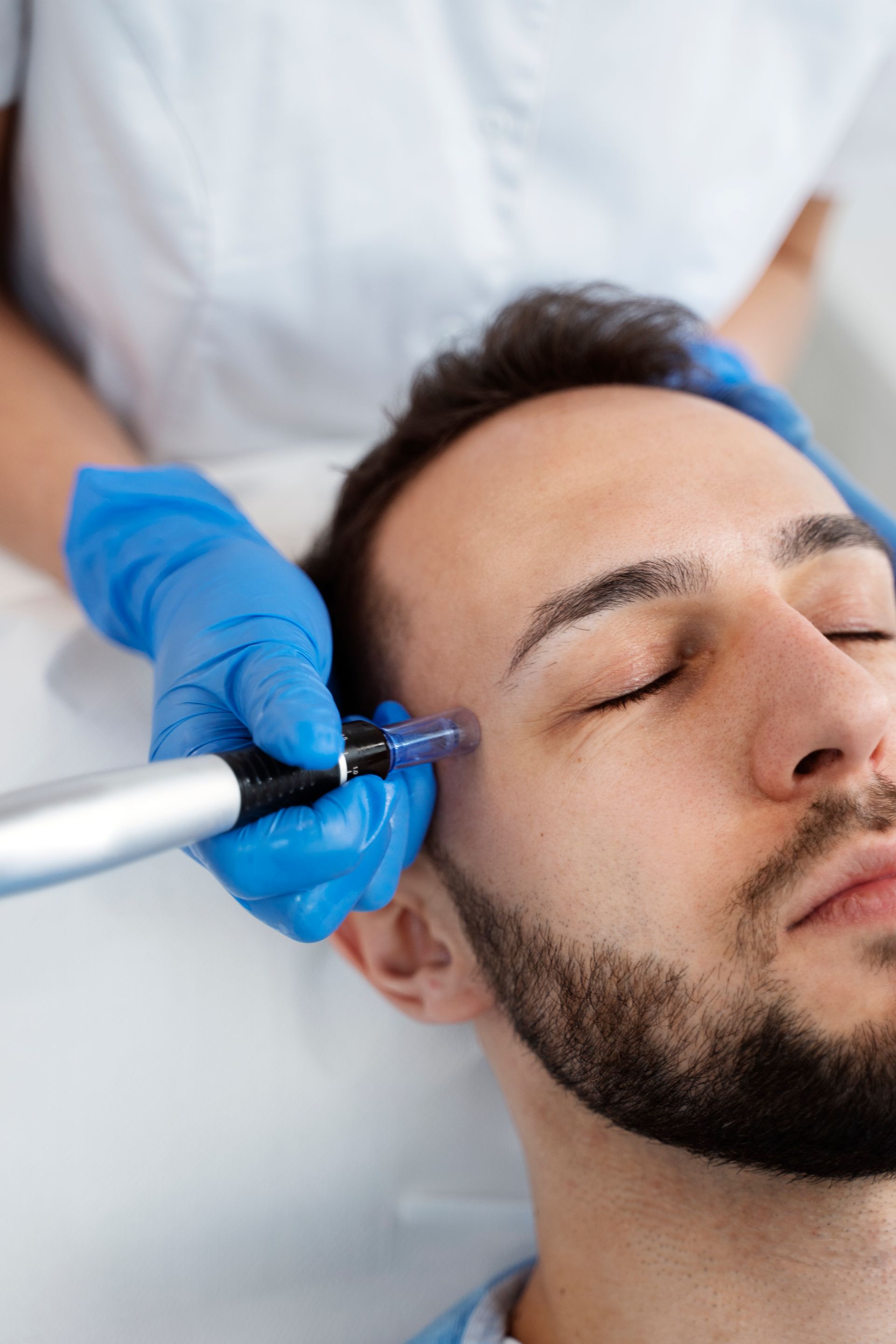 A man is getting a microneedling treatment on his forehead.