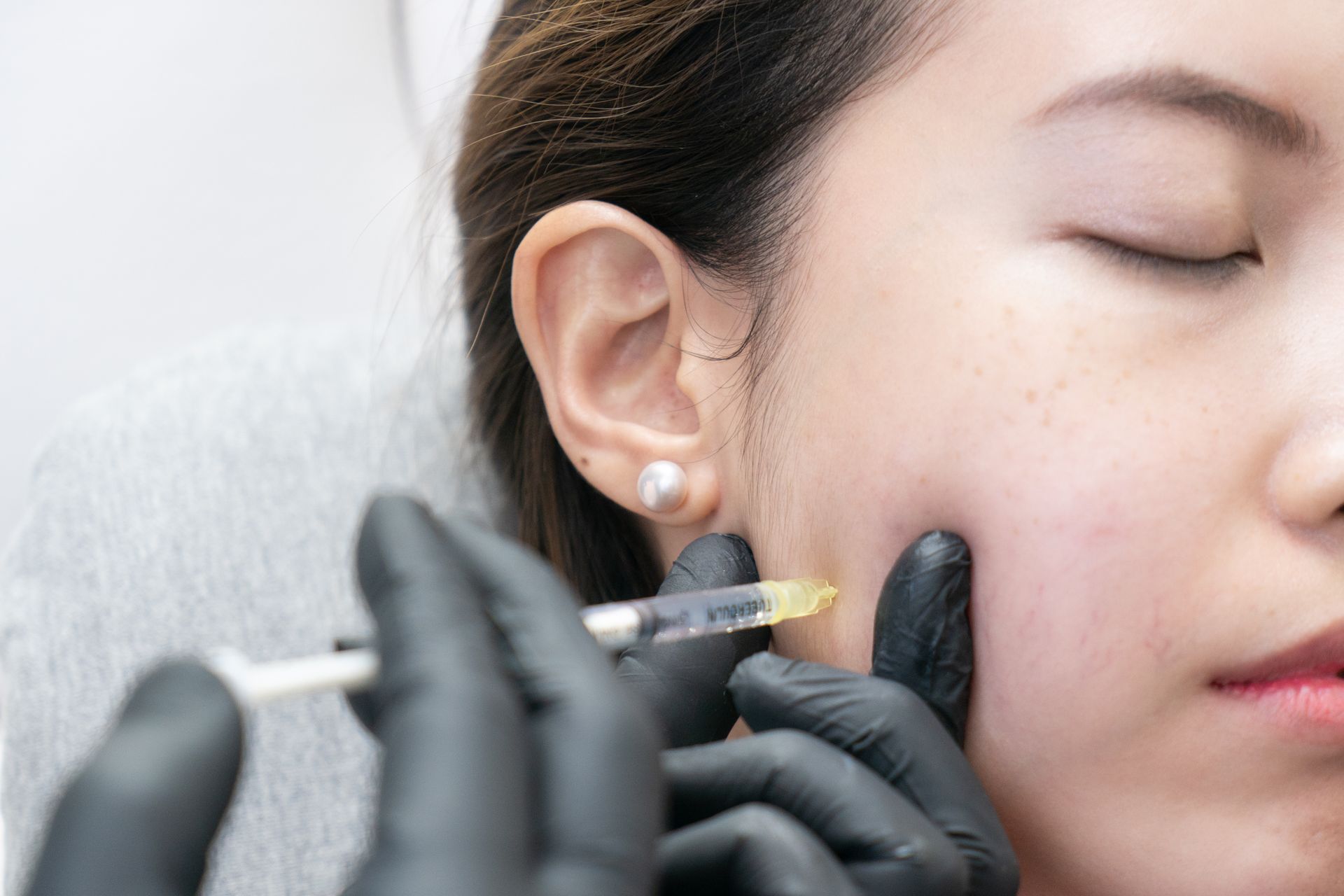 A woman is getting a dermal filler on her cheek.