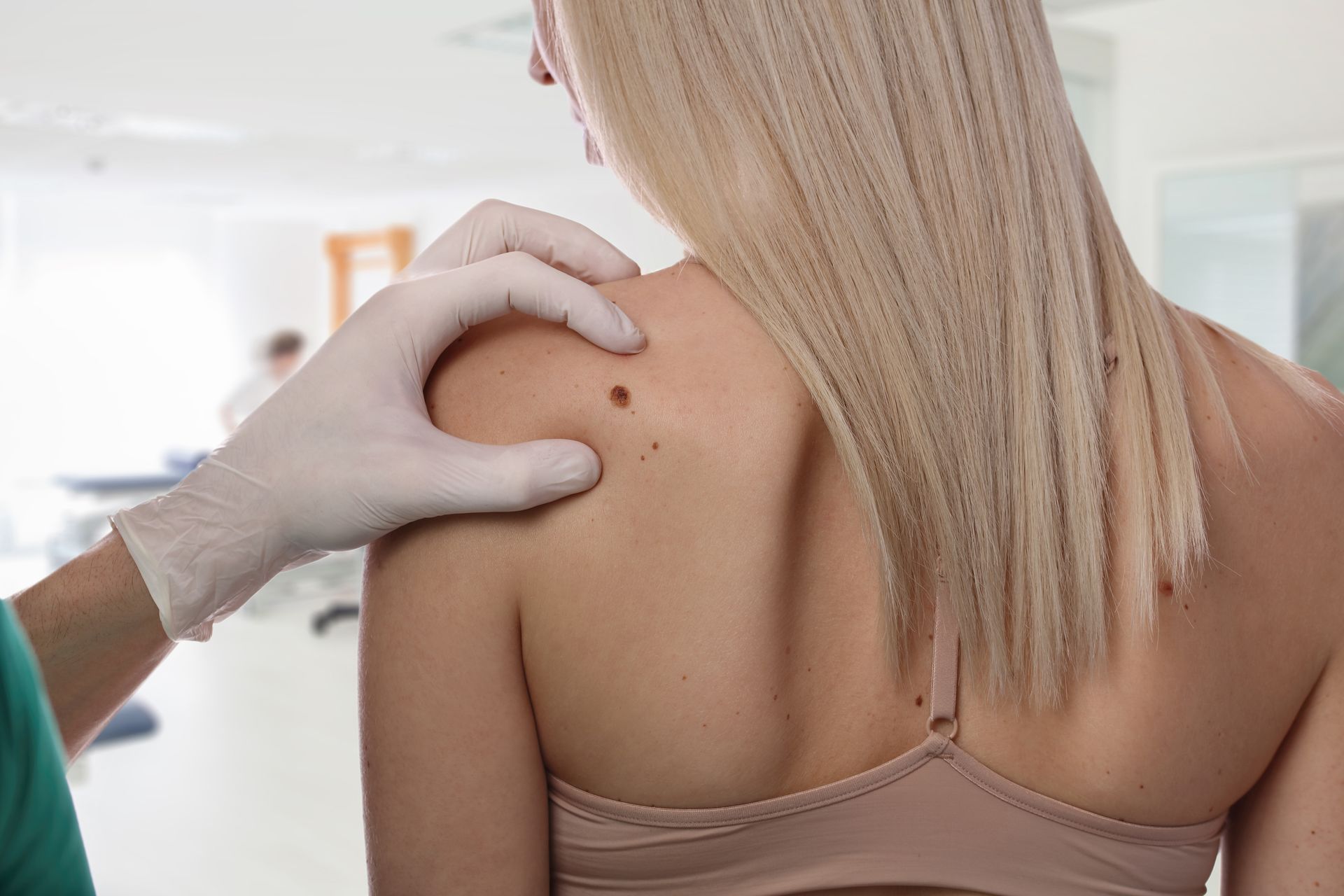 Doctor examining a mole on a patient's shoulder. Blonde hair, medical setting, tan skin.