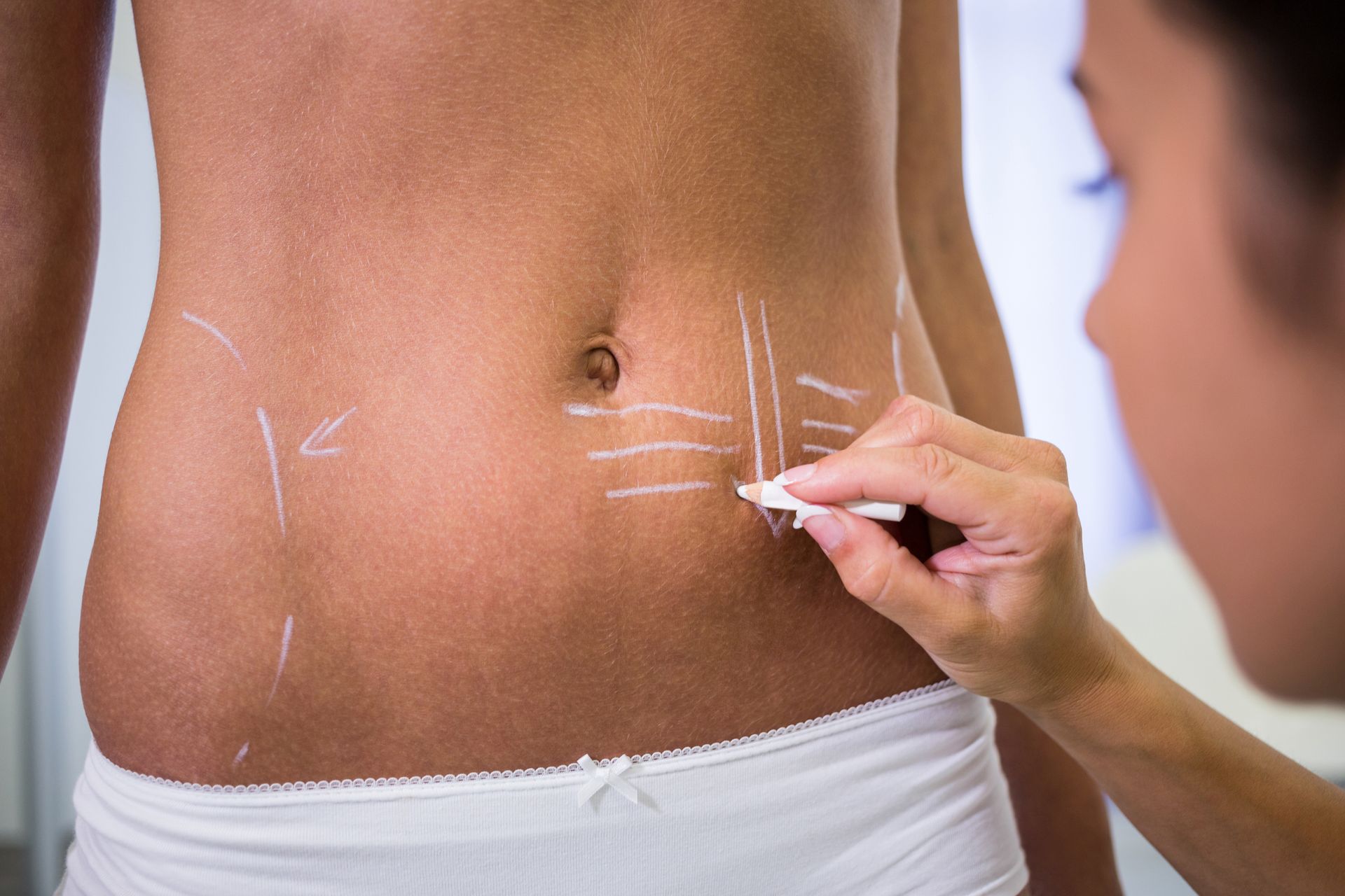 A woman is drawing lines on her stomach with a marker.
