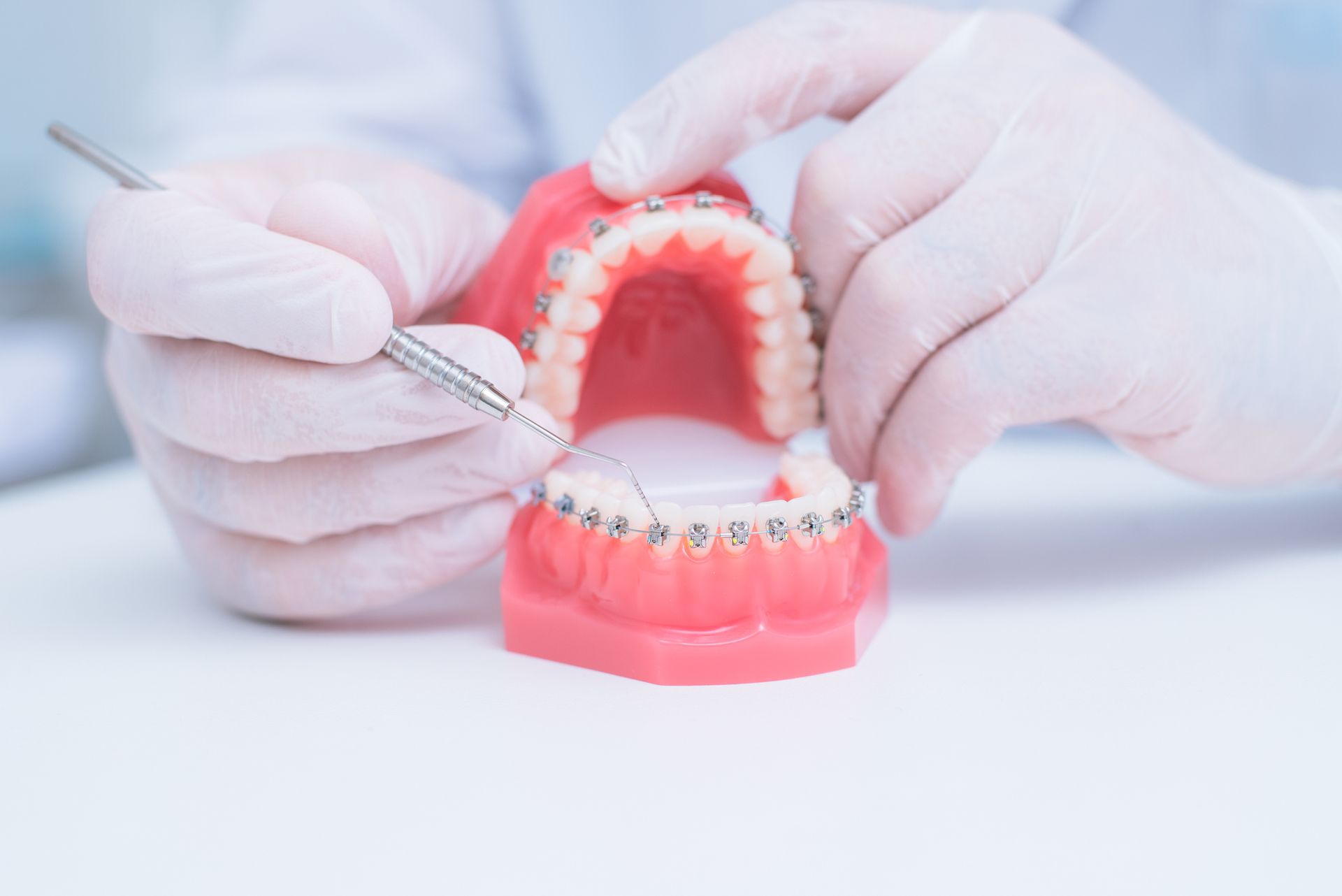 Ortodonzia tradizionale e linguale