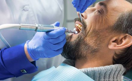 Schutz vor Karies, Parodontitis und Mundgeruch mit regelmäßiger Professioneller Zahnreinigung (PZR)