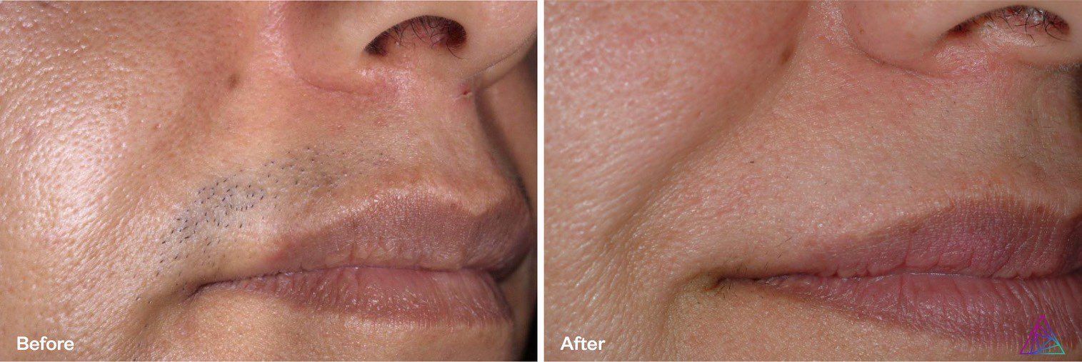 A before and after photo of a man 's face.