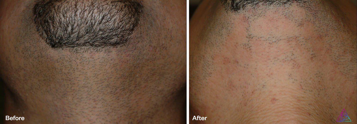 A before and after picture of a man 's face