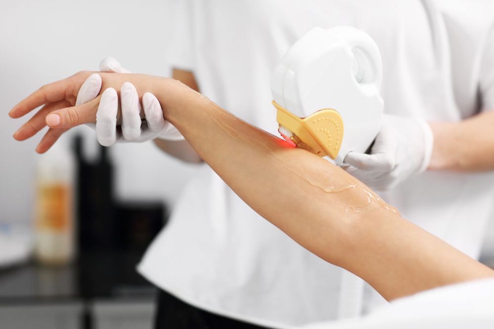 A woman is getting a laser hair removal treatment on her arm.