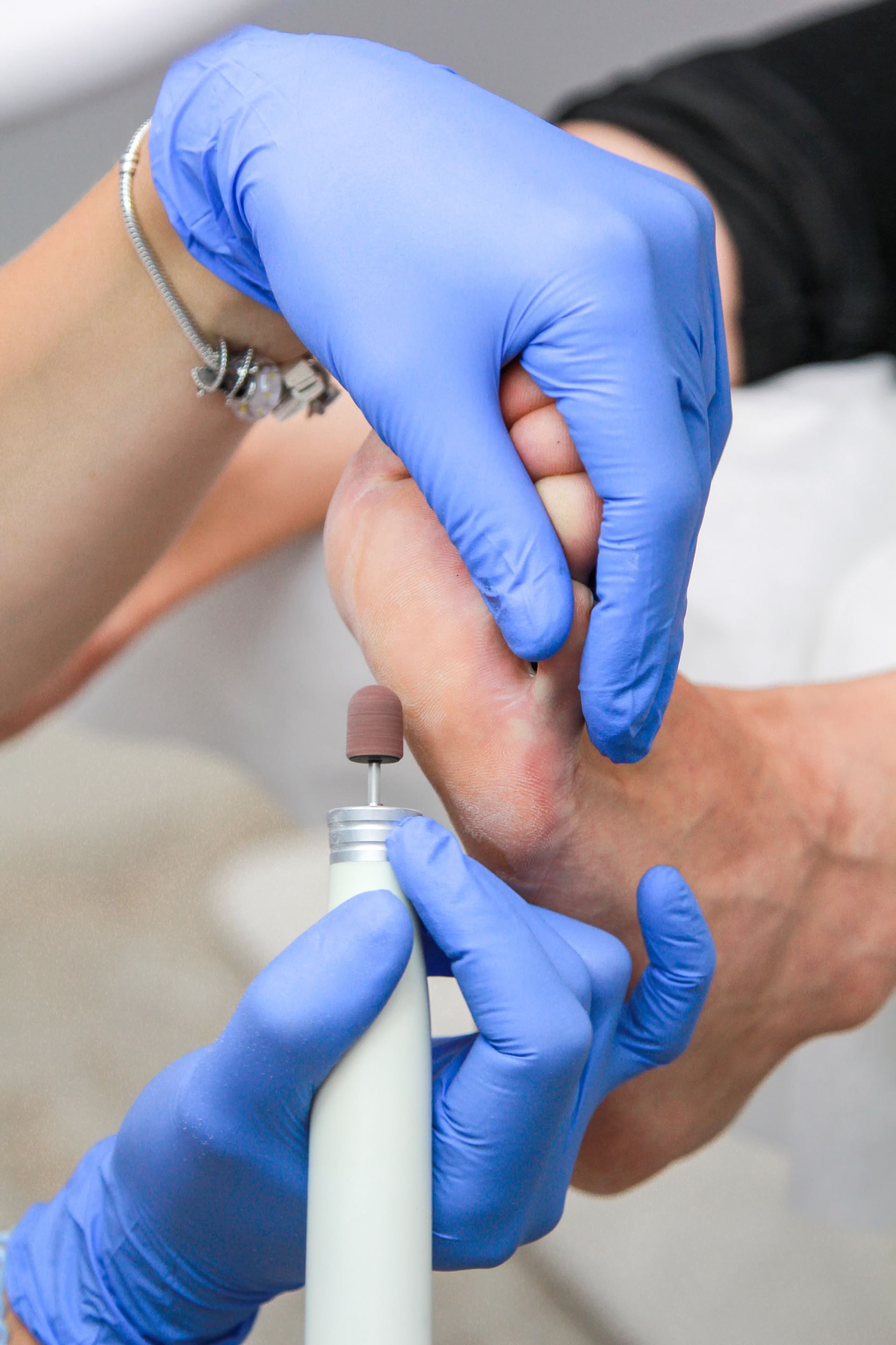 a person getting chirpody treatment