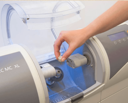 CEREC same day crown