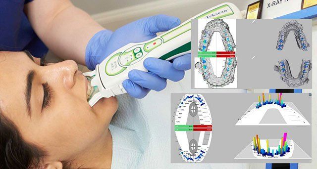 DTR bite measurement tool