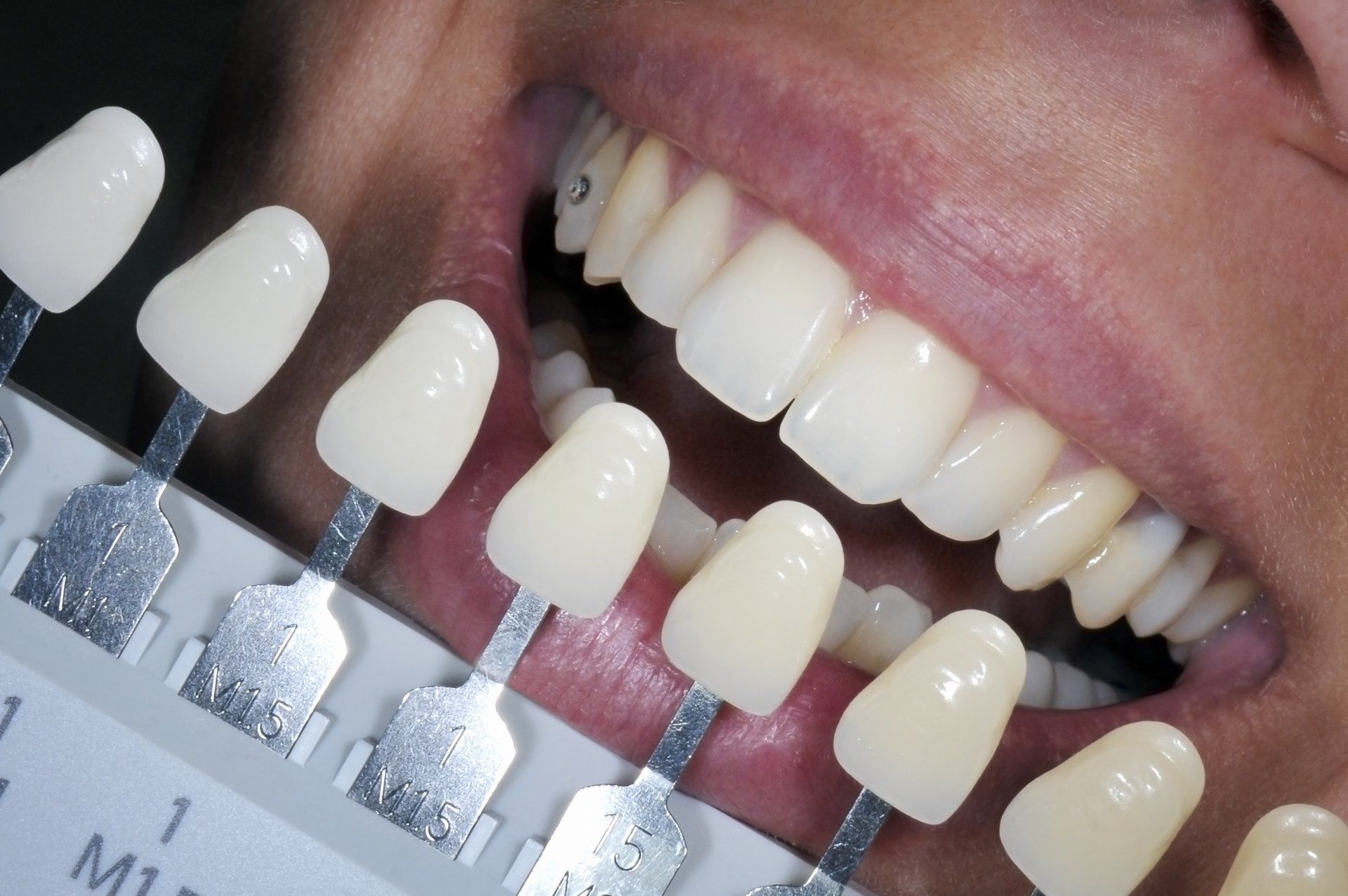 Dentist Holding Dental Tooth Shade - Anchorage, AK - Healthy Smiles Dental
