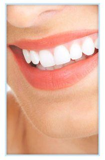 Dental hygienist - Highcliffe, Christchurch - Highcliffe Dental Practice - Teeth whitening