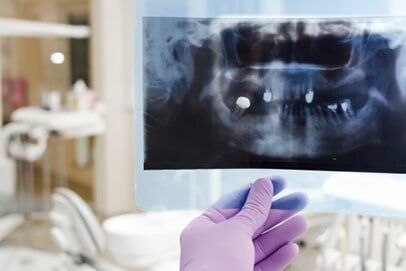 Hand Holding X-ray Result — Burnsville, MN — Centerpointe Dental
