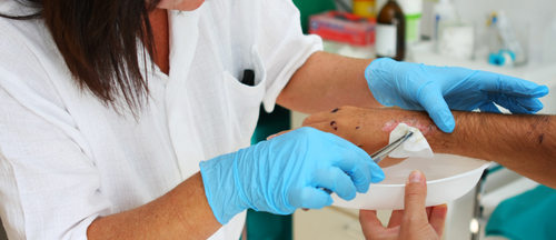 Wound Care