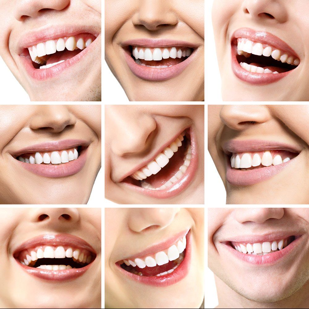 Montage of Beautiful Smiles — Hunter Family Dentistry in Terrigal, NSW