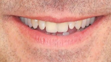 Close-up of a man's smiling mouth with visible teeth, slightly parted lips, and a gap between his front teeth.