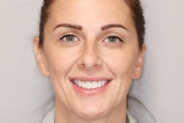 Woman with fair skin, smiling, brown hair pulled back, and professionally done eyebrows.