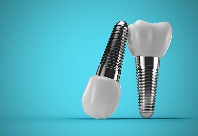 Two dental implants with porcelain crowns, against a light blue background. One is upright, the other tilted.