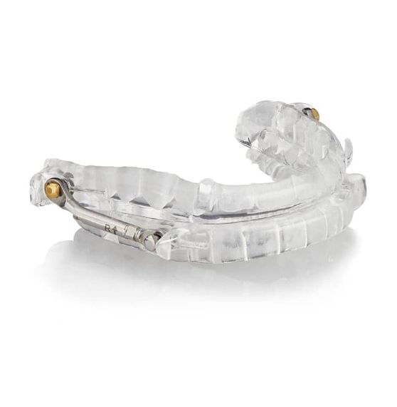 Clear, molded dental device, a mandibular advancement splint, for treating sleep apnea. It has metal hinges.