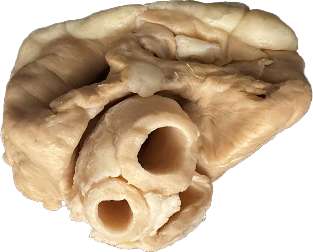 Plastinated Cow's Heart