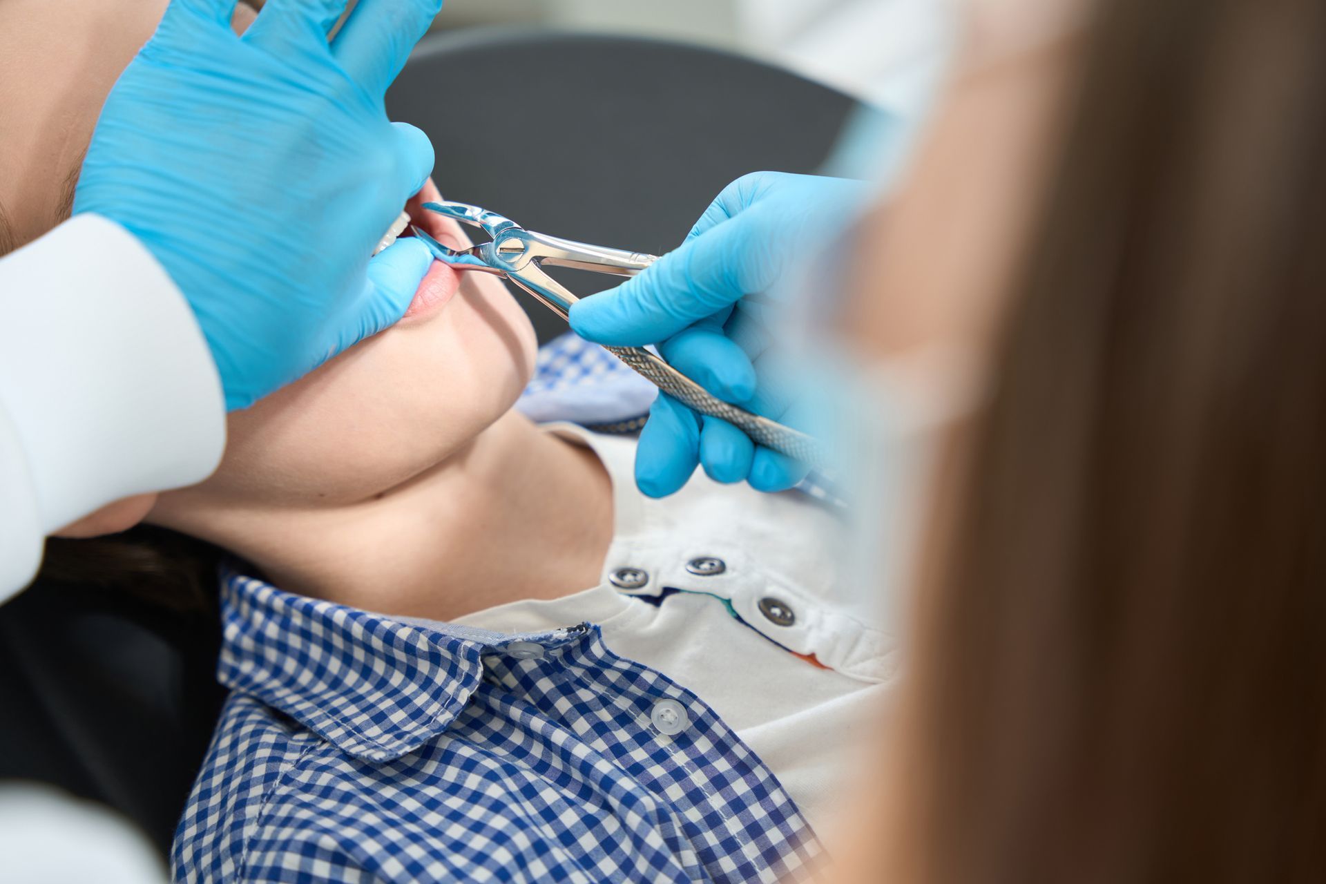 Dentist Pulling Teeth - Ngunnawal, ACT - Capital Dentistry
