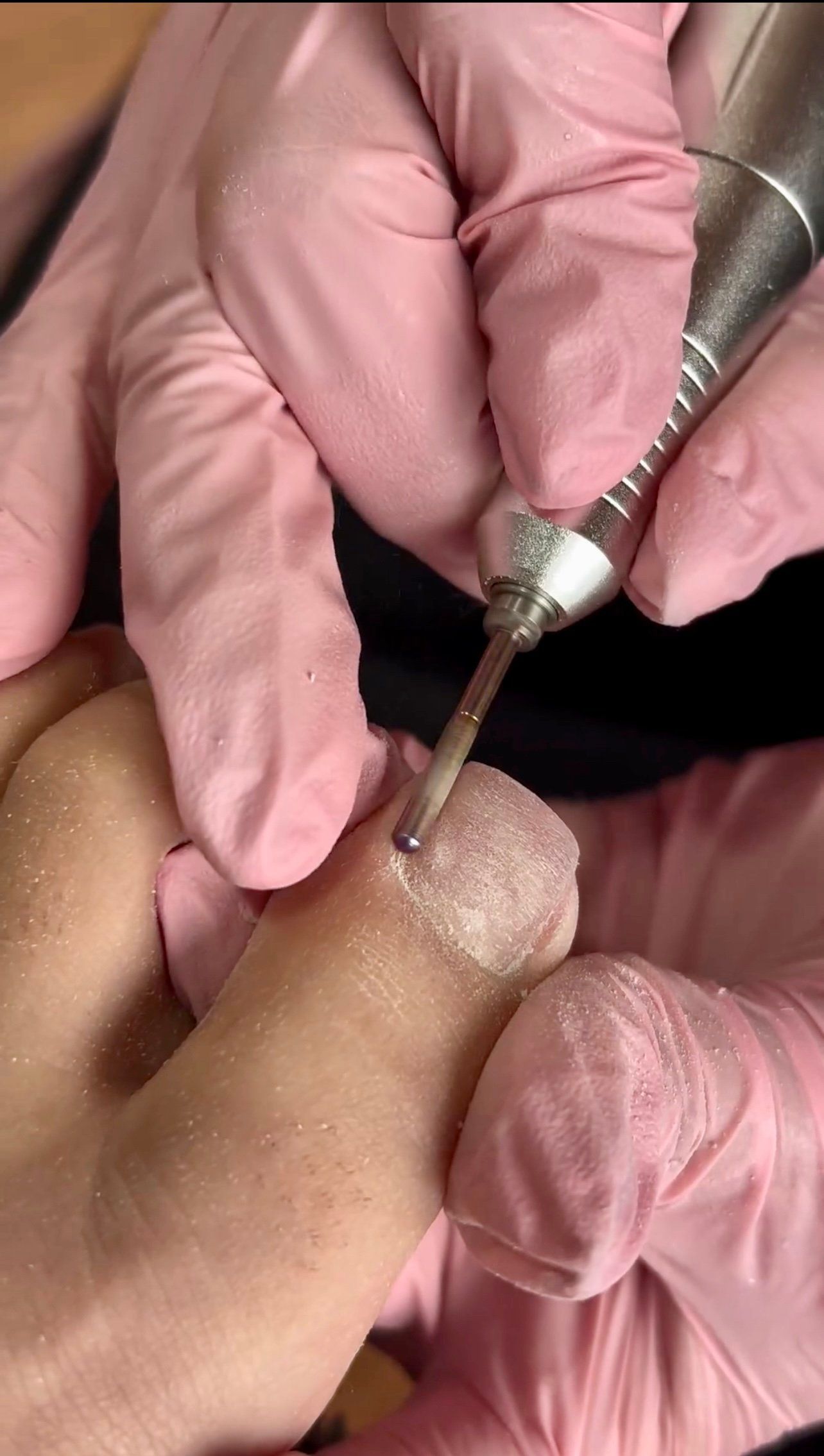 pedicure acripie