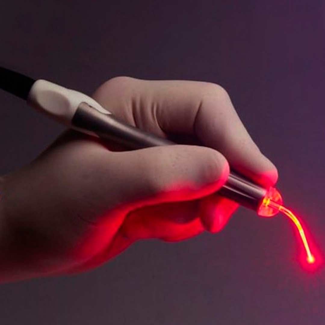 Mano sosteniendo una herramienta láser que emite una luz roja.