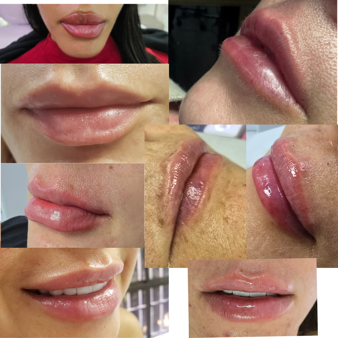 tratamiento médico para hidratar labios