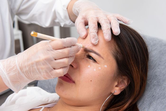 Botox en Medellín, medica estética en medellín, dermatóloga en Medellín