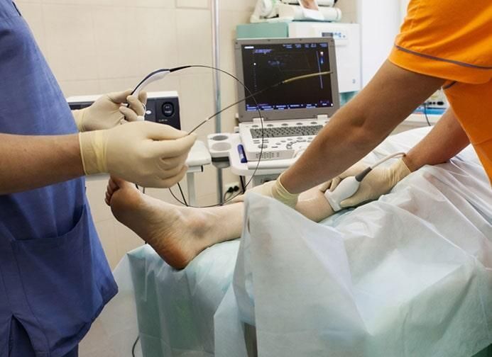 ANGIOLOGÍA Y CIRUGÍA VASCULAR DR. ERNESTO PACHECO P