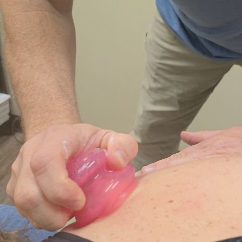 Lance Thompson applying a cupping technique to increase blood flow and pain relief.