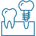 Dental Implant icon | Get affordable dental implant in Temecula CA 92592