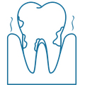 Periodontal therapy | Best adult and pediatric dentist for fillings, gum disease, root canals, and bridges | Temecula CA